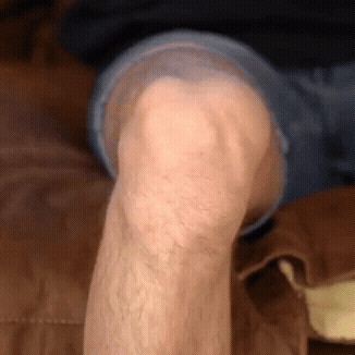 Got Arthritis, Swelling, or Soarness in the Knees?